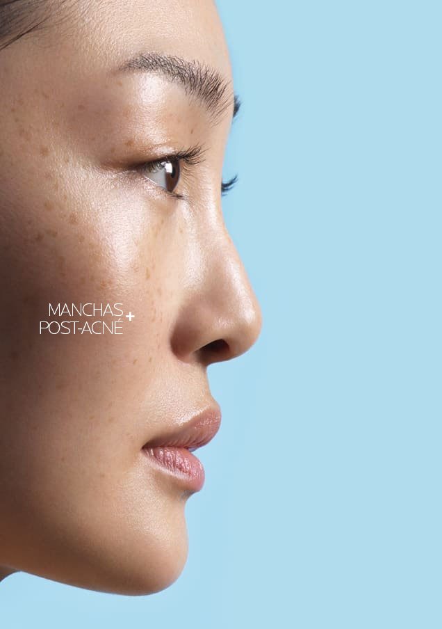 /-/media/project/loreal/brand-sites/lrp/america/latam/products/effaclar/effaclar-a-z-gel-cream/desktop/lrp-effaclar_azcream_flip_card_front_desktop_3.jpg